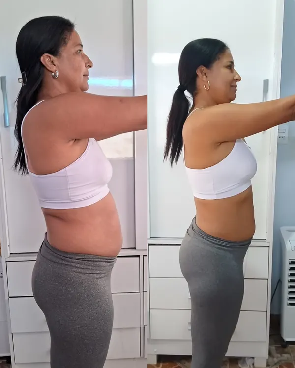 Antes e depois de aluna do Mateus