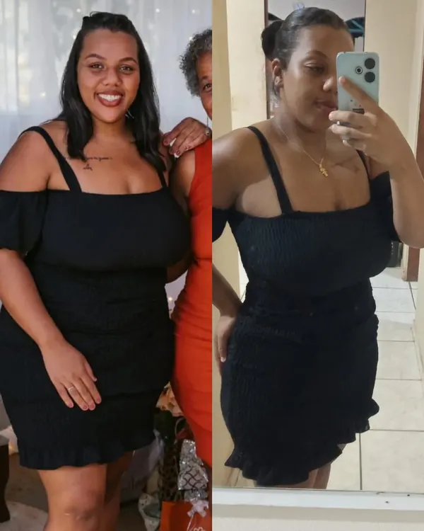 Antes e depois de aluna do Mateus